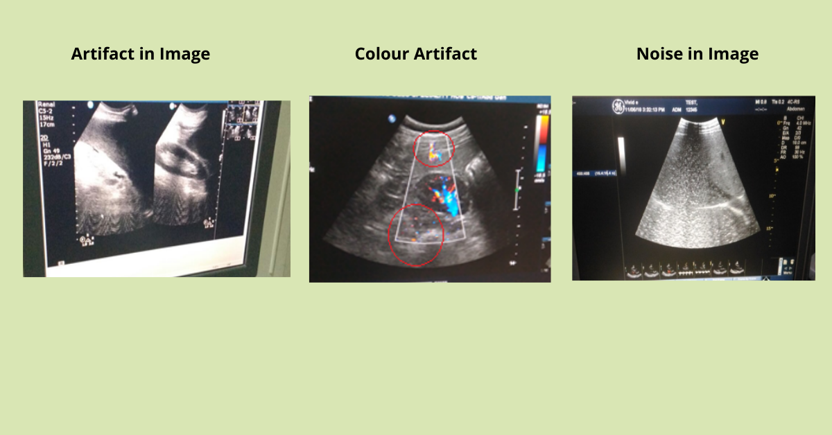 Ultrasound Probe Repair or Replace ?